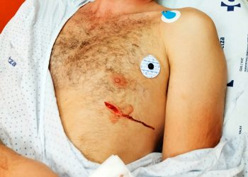 Militante político atacado por un grupo fascista en Barakaldo