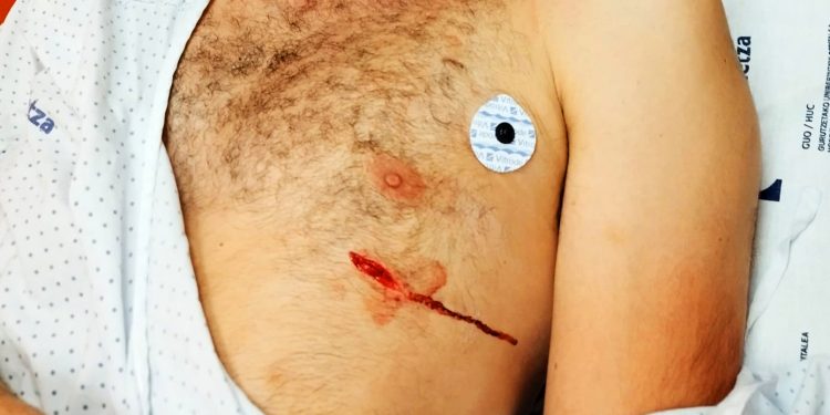 Militante político atacado por un grupo fascista en Barakaldo