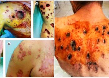 ISRAEL bombardea las inmediaciones de una escuela de la UNRWA con fósforo blanco