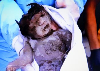 La barbarie del asesino Estado sionista en Gaza mostrada en toda su crudeza (vídeos)