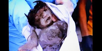 La barbarie del asesino Estado sionista en Gaza mostrada en toda su crudeza (vídeos)