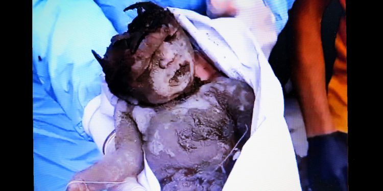 La barbarie del asesino Estado sionista en Gaza mostrada en toda su crudeza (vídeos)