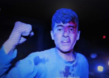 Tras sufrir un bombardeo sionista, este chaval gritó estas comprensibles y contundentes palabras (vídeo)