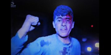 Tras sufrir un bombardeo sionista, este chaval gritó estas comprensibles y contundentes palabras (vídeo)