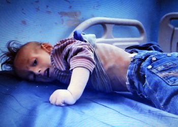 Se llamaba Muhannad Al-Najjar y murió de inanición, asesinado por el Estado sionista (vídeo)