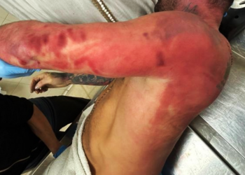 Una persona falleció en Astigarraga tras una violenta intervención de la Ertzaintza