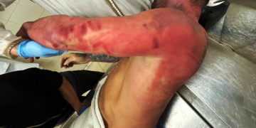 Una persona falleció en Astigarraga tras una violenta intervención de la Ertzaintza