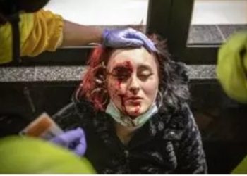 «Para el juez que está llevando mi caso, mi mutilación es considerada justa porque yo me expuse a ella»