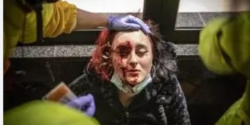 «Para el juez que está llevando mi caso, mi mutilación es considerada justa porque yo me expuse a ella»