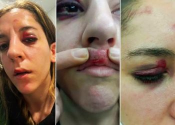 Un Mosso agredió a Joana durante un desahucio ilegal; ahora la agredida ha recibido condena de cárcel