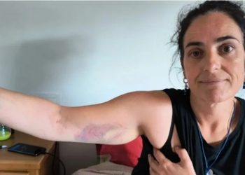 Ponen en libertad con pruebas inequívocas de violencia a la dirigente del BNG Rosana Prieto