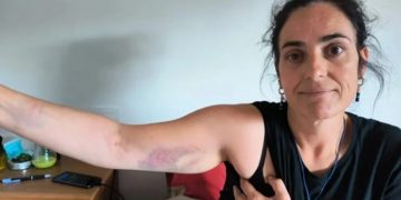 Ponen en libertad con pruebas inequívocas de violencia a la dirigente del BNG Rosana Prieto