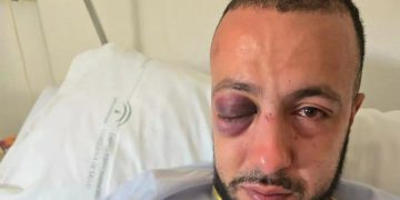 Una jueza exculpa a un subinspector de la Policia Nacional de torturas, detención ilegal, falsedad…