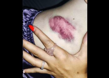 Iruñea en Sanfermines: La Policía Nacional cargó hiriendo a varias personas y practicando una detención