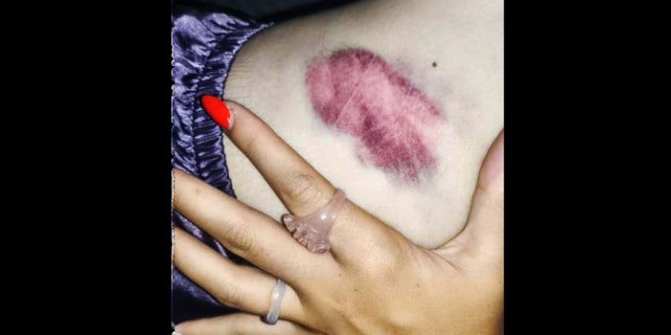 Iruñea en Sanfermines: La Policía Nacional cargó hiriendo a varias personas y practicando una detención