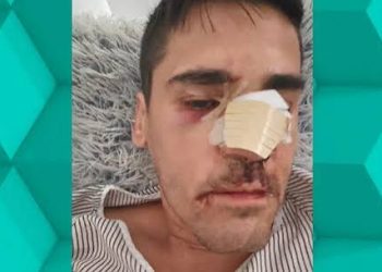 El fascismo anda suelto y con rabia: agreden al escritor y periodista Fonsi Loaiza