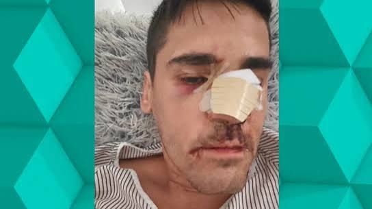El fascismo anda suelto y con rabia: agreden al escritor y periodista Fonsi Loaiza