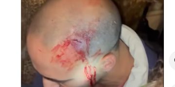 Oporto. La policía desmantela con extrema violencia la acampada por el derecho a una vivienda digna