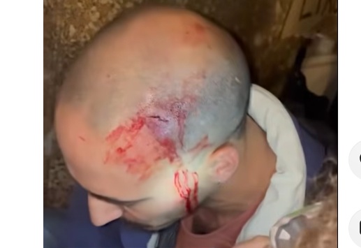 Oporto. La policía desmantela con extrema violencia la acampada por el derecho a una vivienda digna